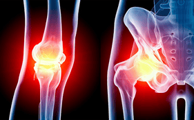 Hip Knee Total Joint.png