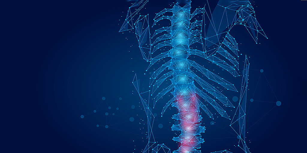 Q220 CAS Spine Header