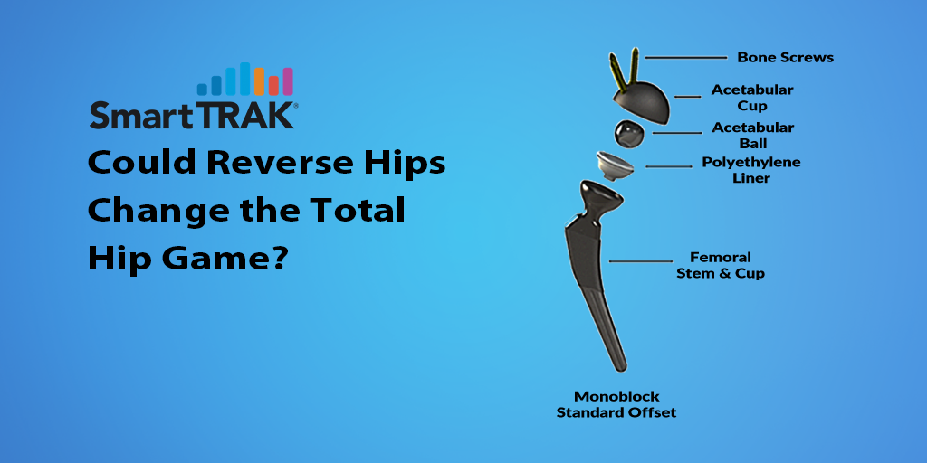Could Reverse Hips Change the Total Hip Game?